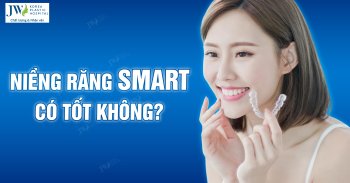 Niềng răng SMART là gì, có tốt không?
