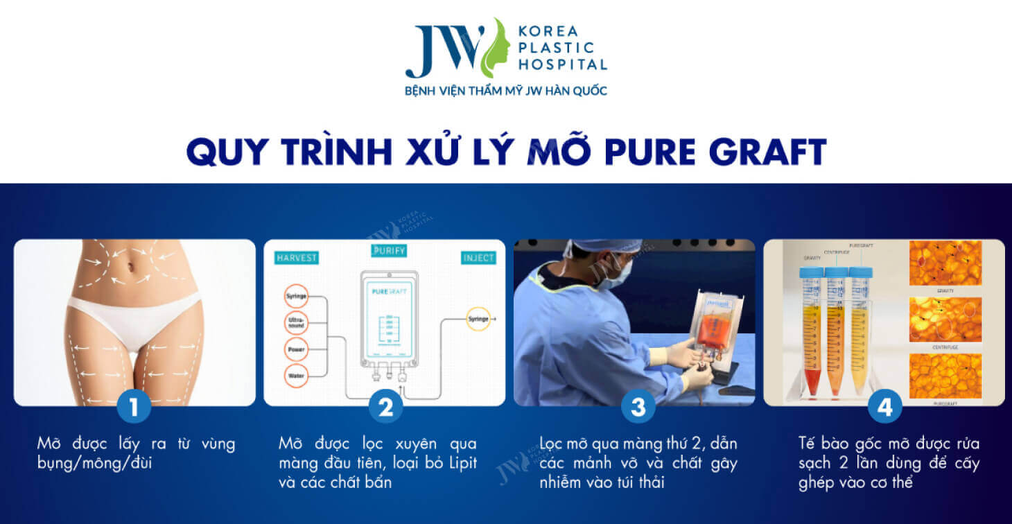 quy-trinh-xu-ly-mo-nhan-tao-jw