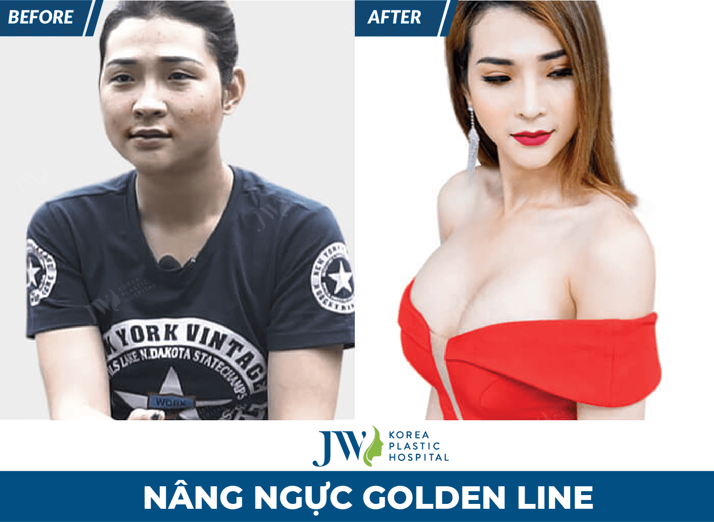 nang nguc golden line jw