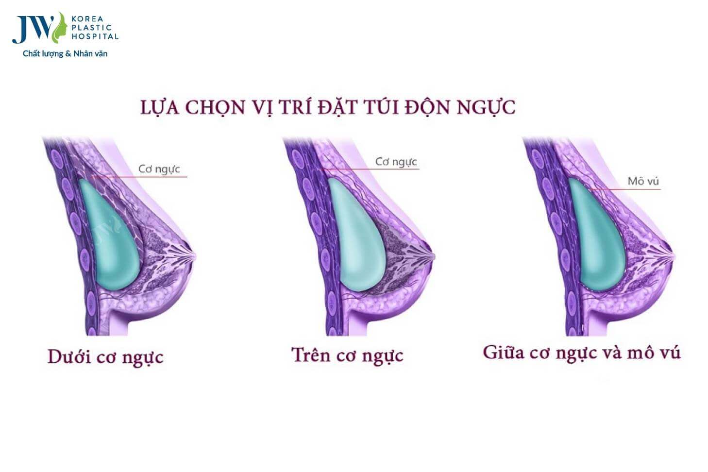 cac buoc dat tui nguc