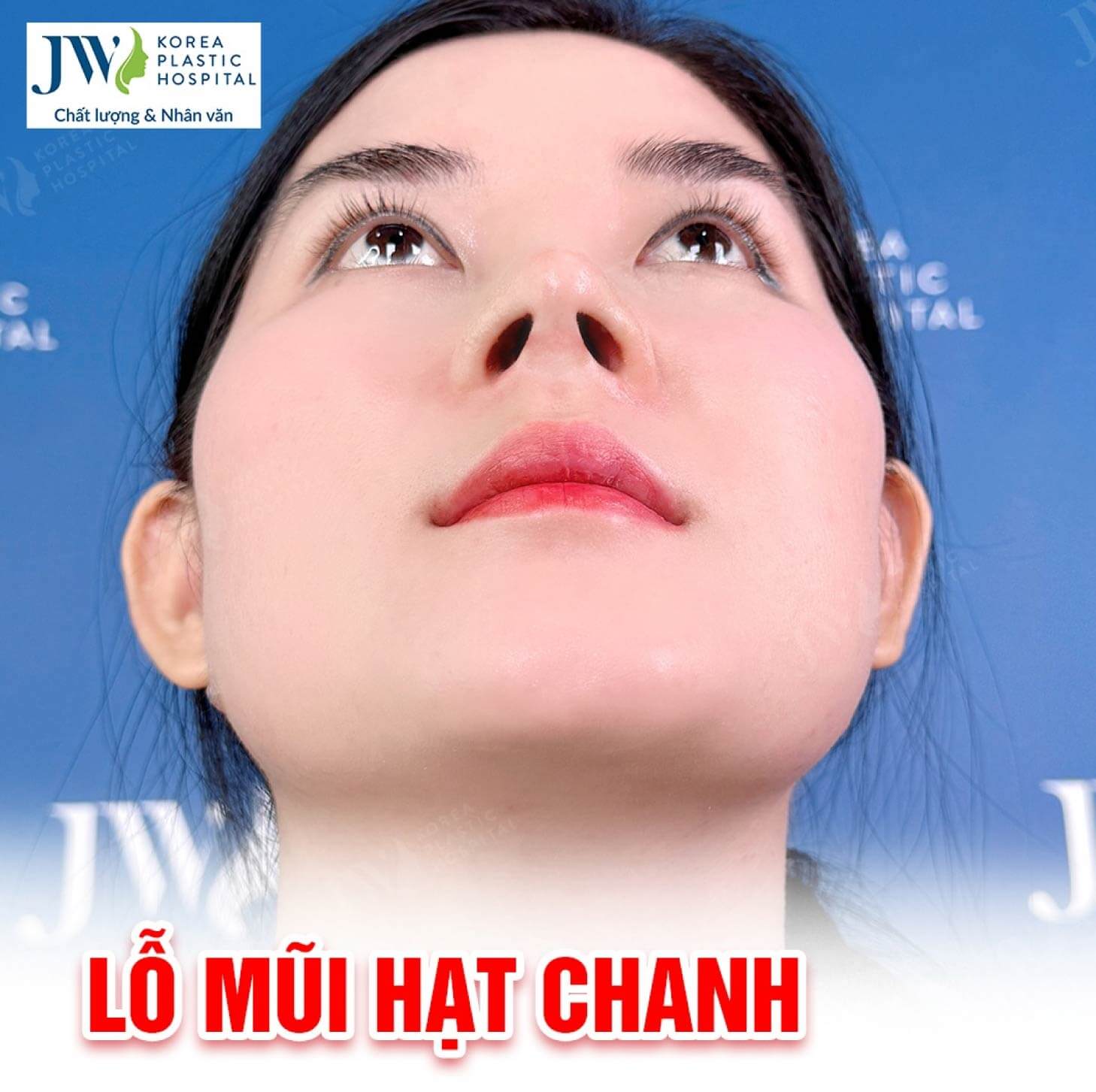 lo-mui-hat-chanh