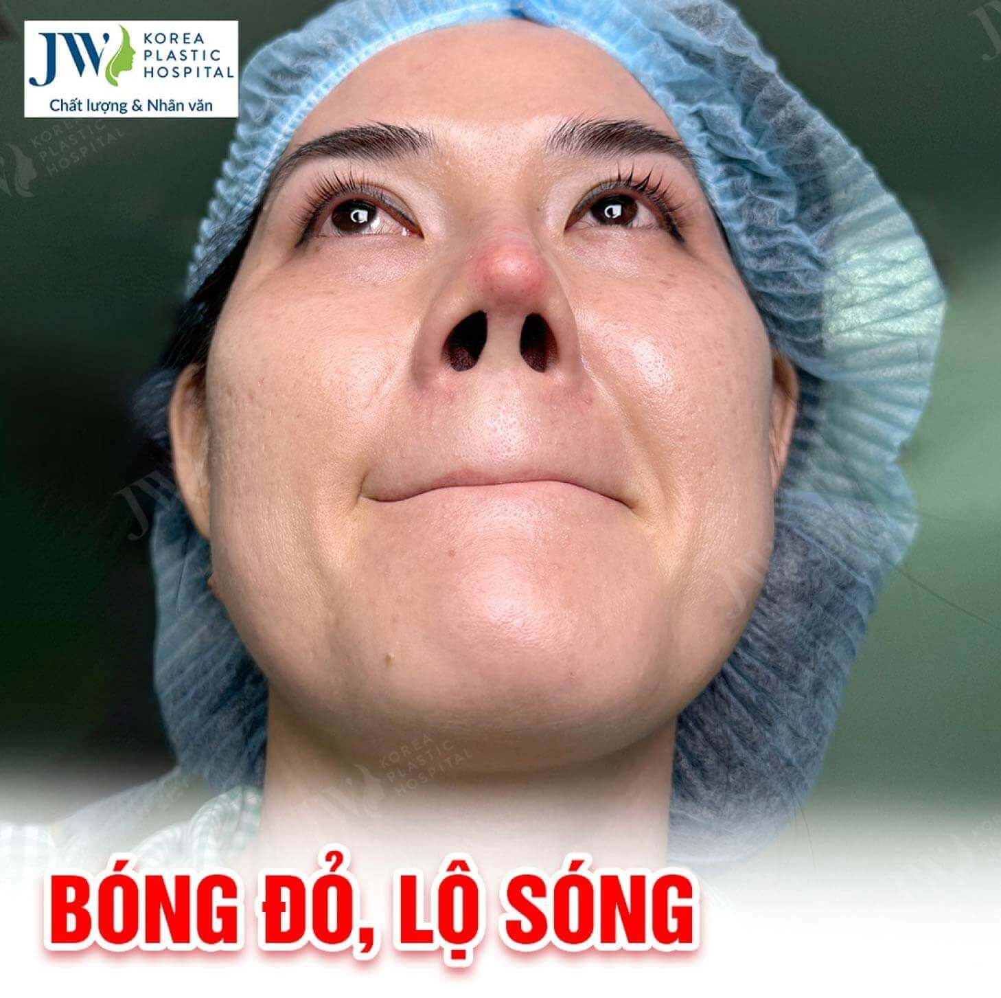mui-lo-song