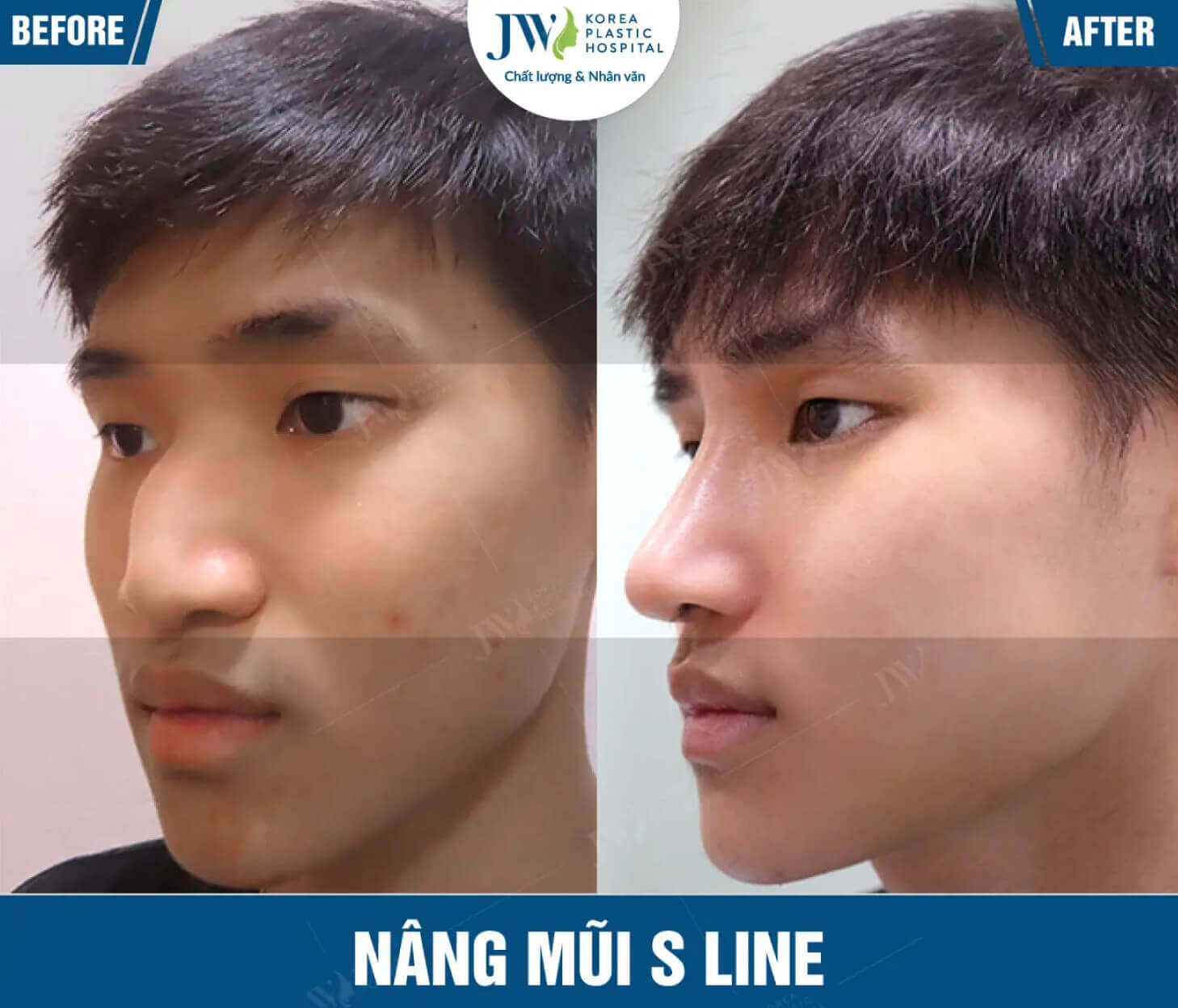 nang mui 2 1