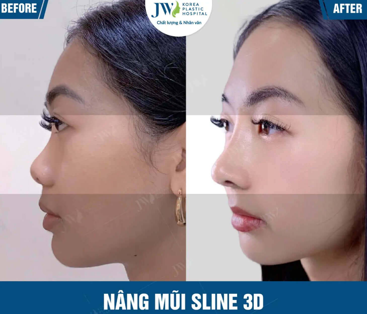 nang mui 3 1