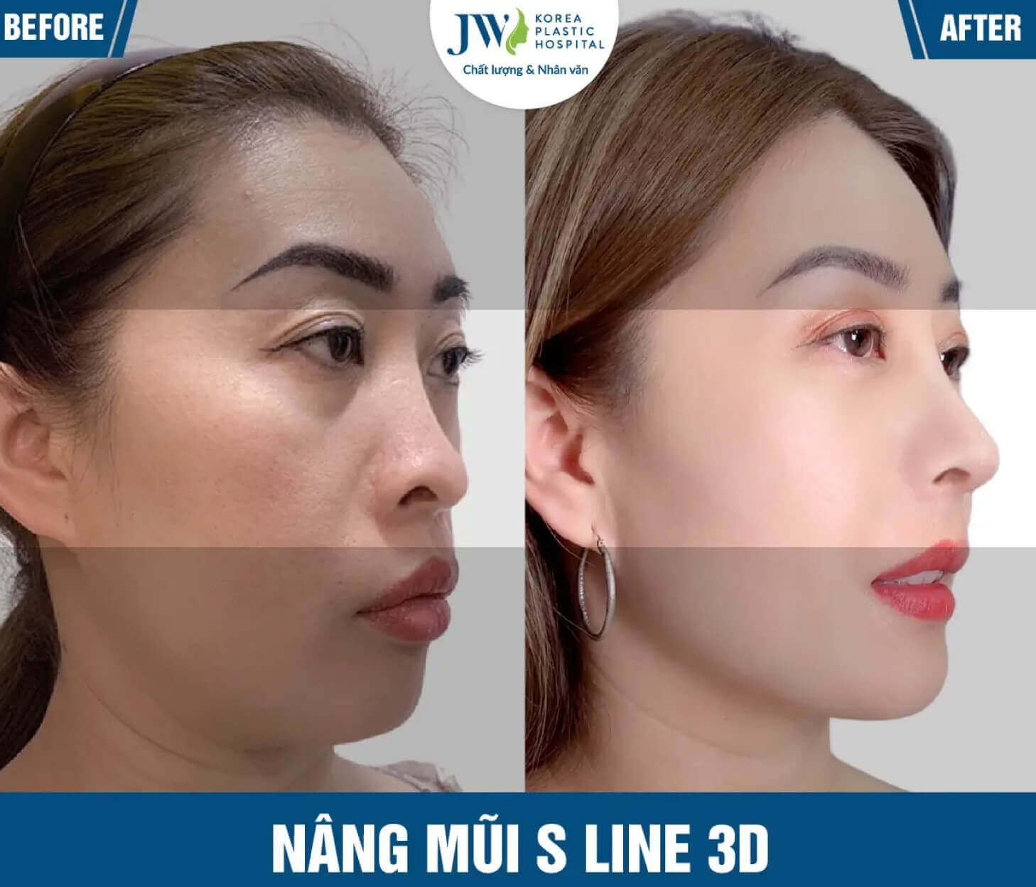 nang mui 4 1