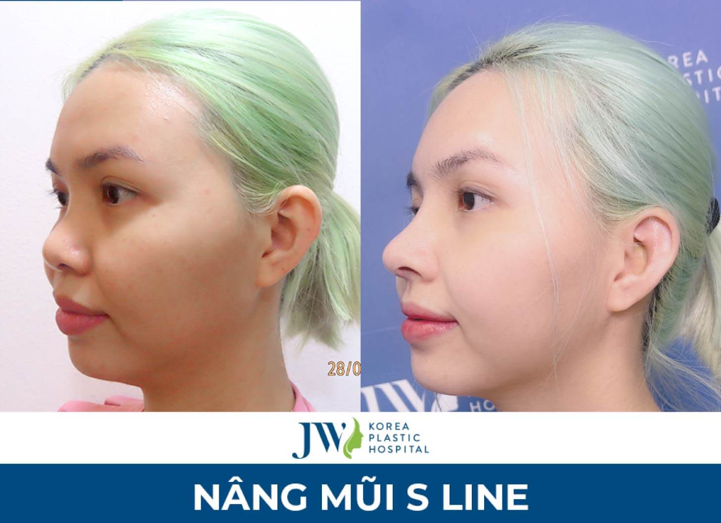 nang-mui-sline