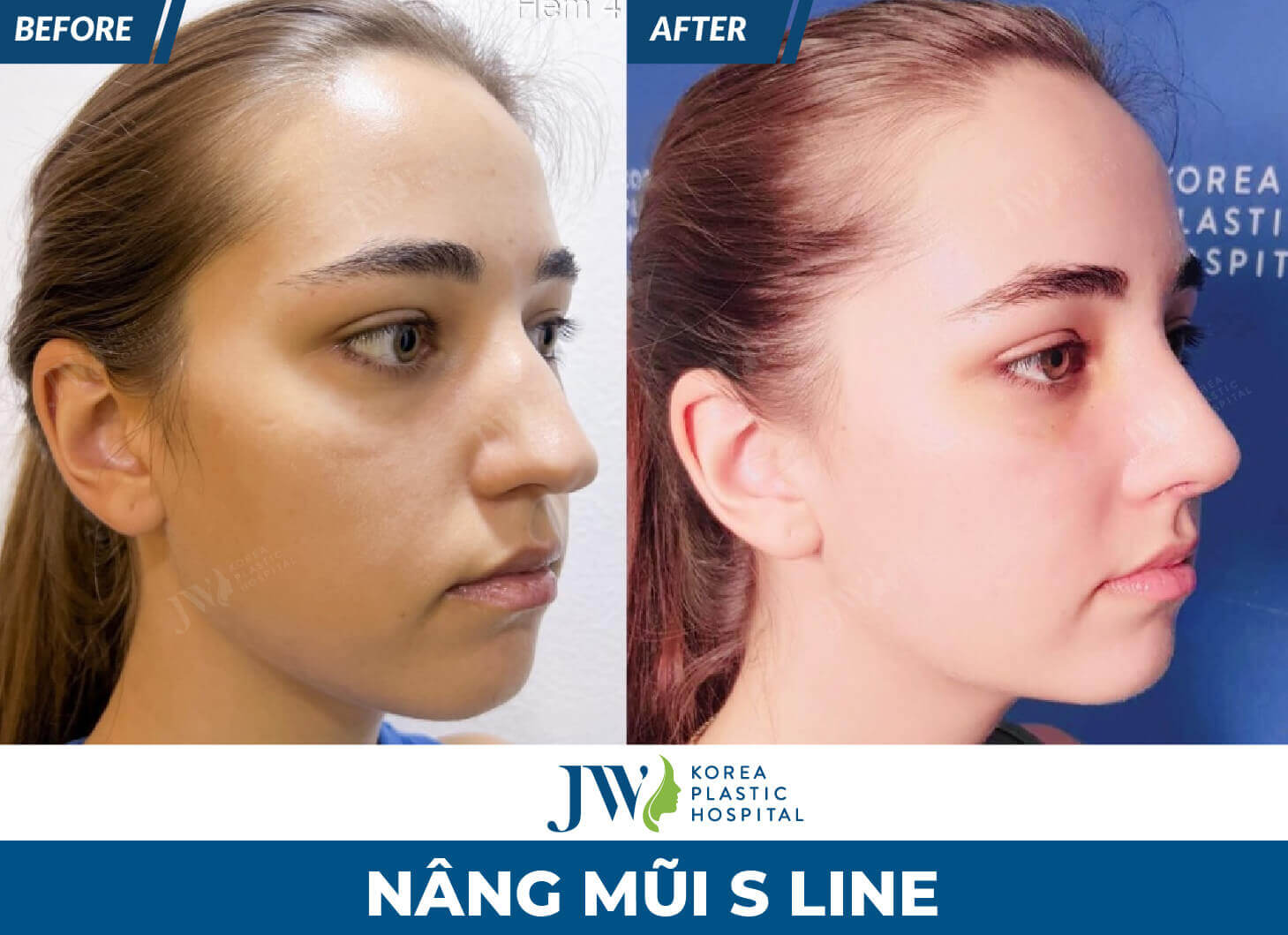 nang mui s line 
