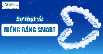 Sự thật về niềng răng SMART mà bạn nên biết 