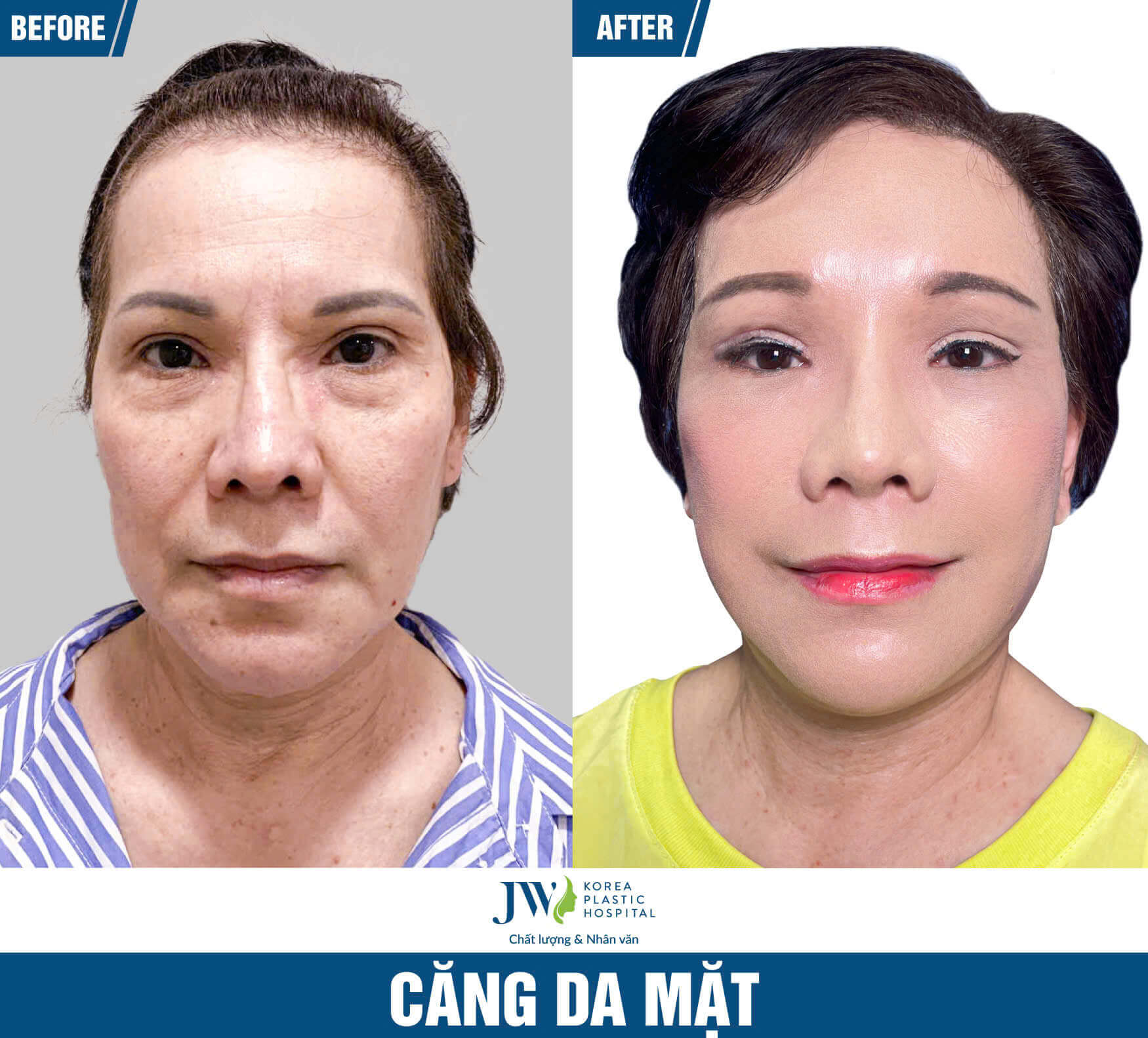 cang-da-mat