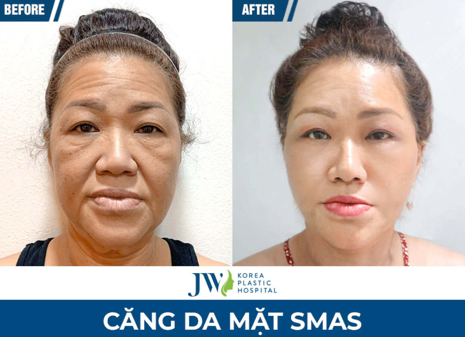 cang-da-mat