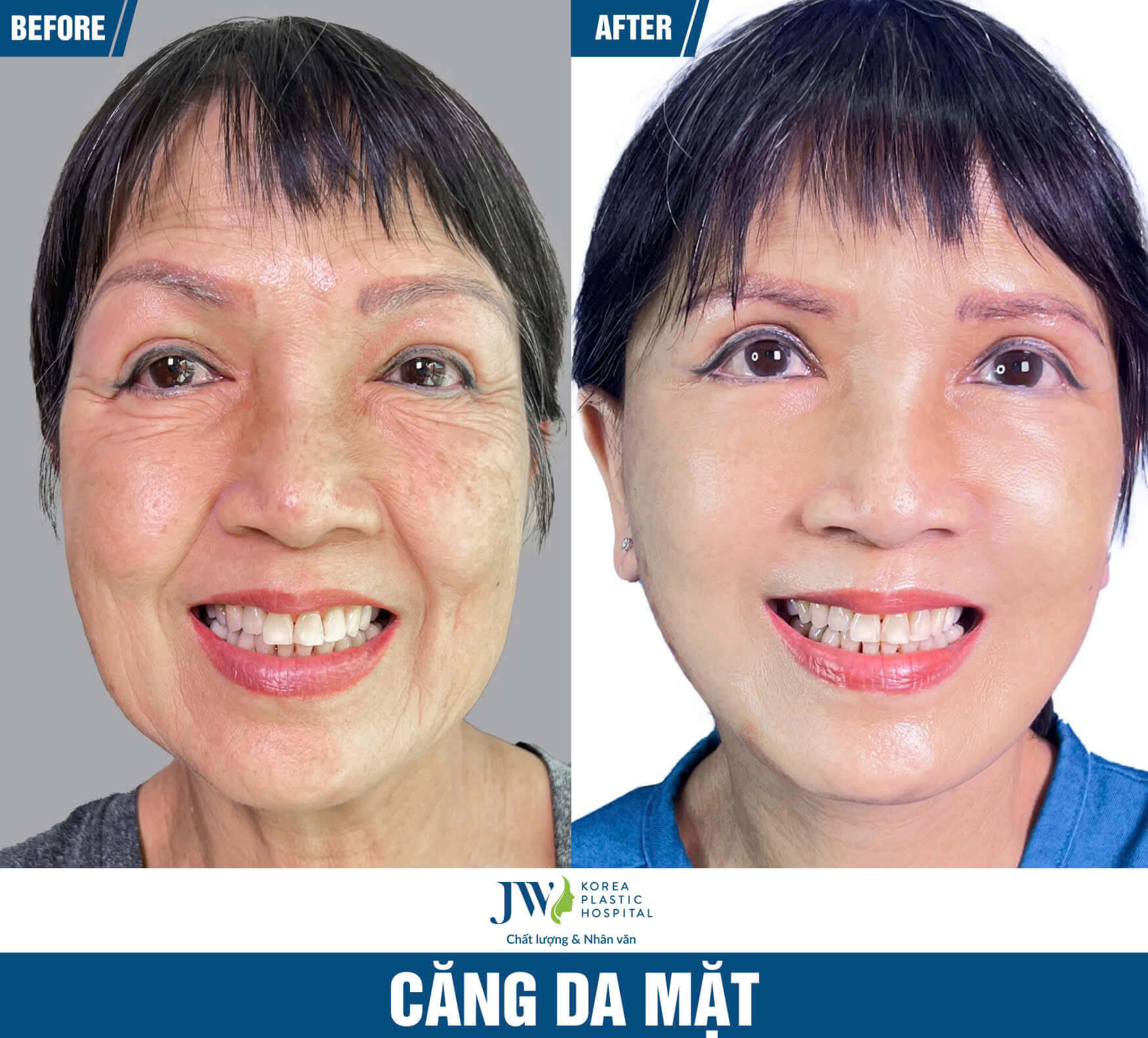 cang da mat