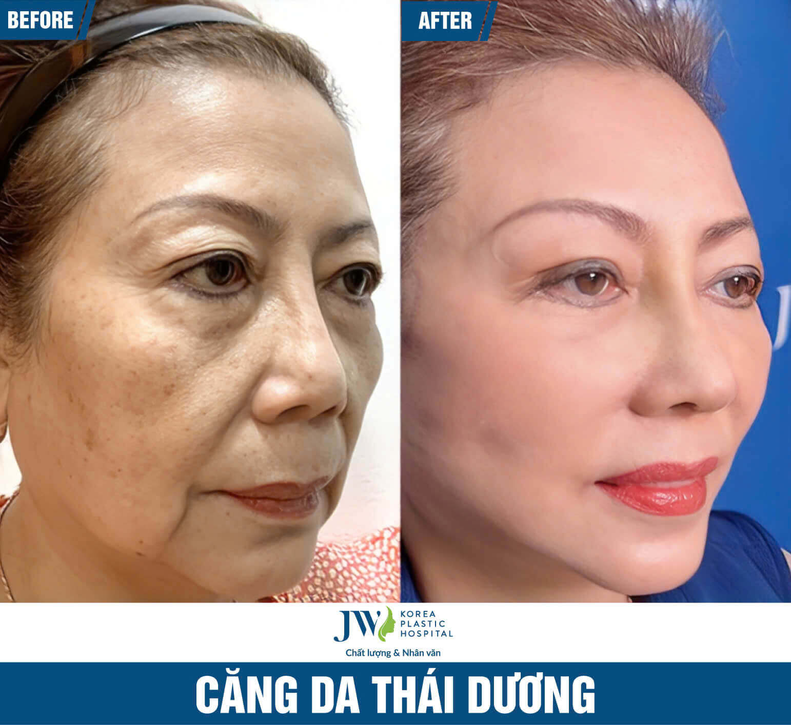 cang-da-mat