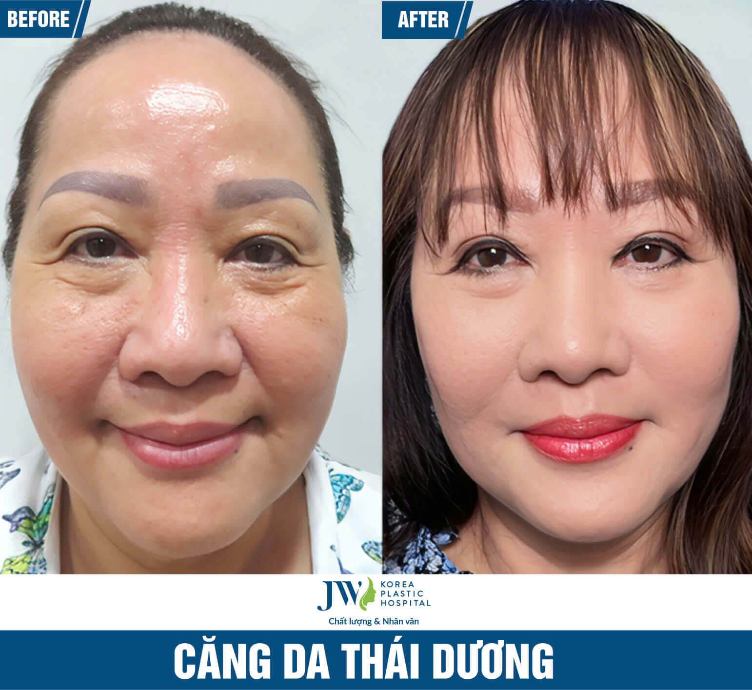 cang-da-mat