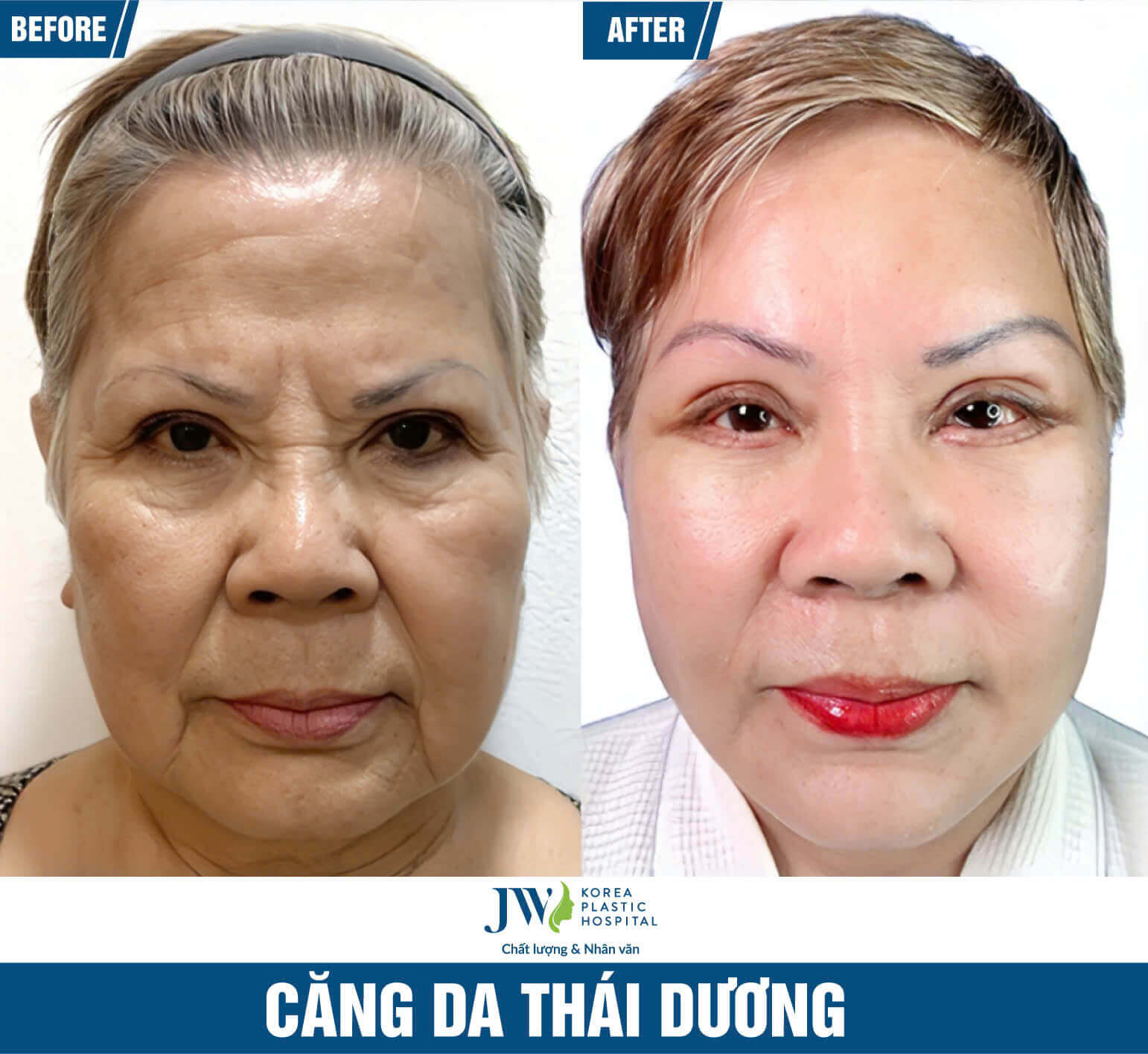 cang-da-thai-duong