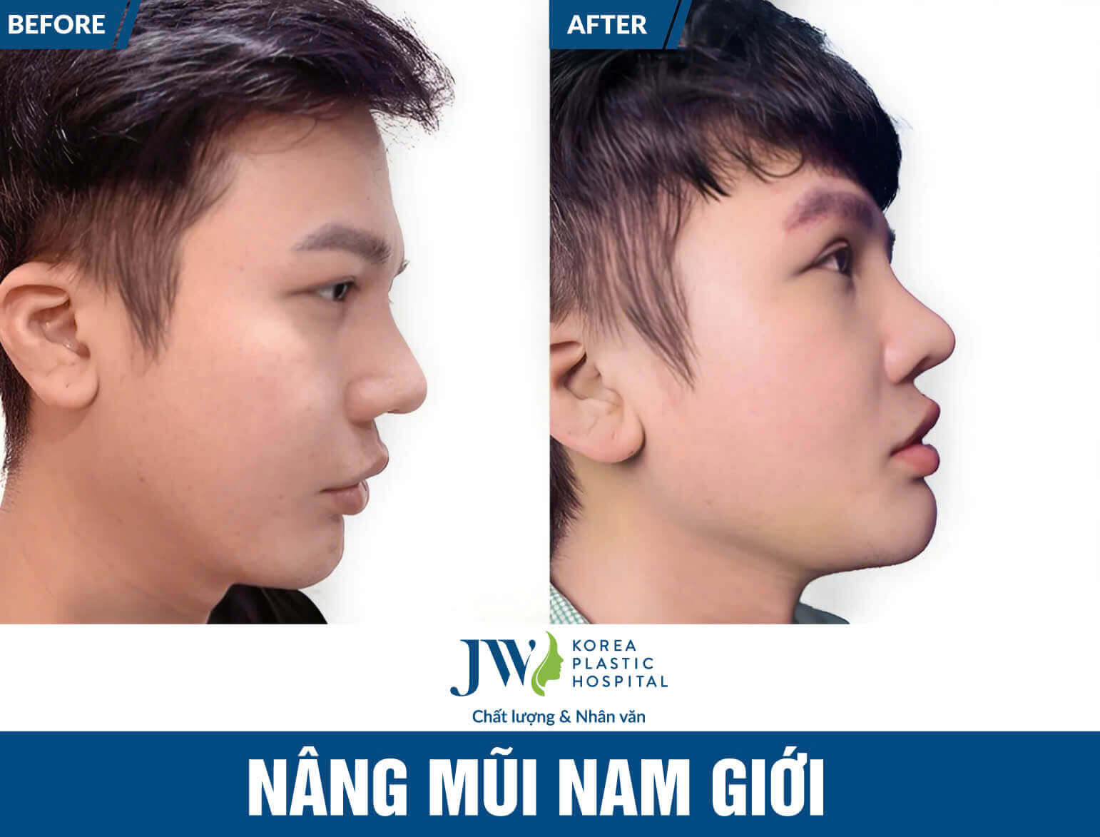 nang-mui-nam-gioi