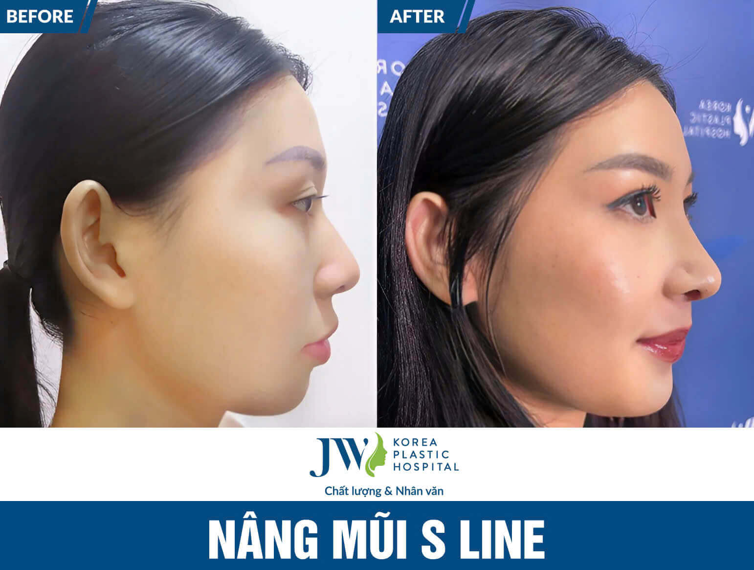nang-mui-s-line