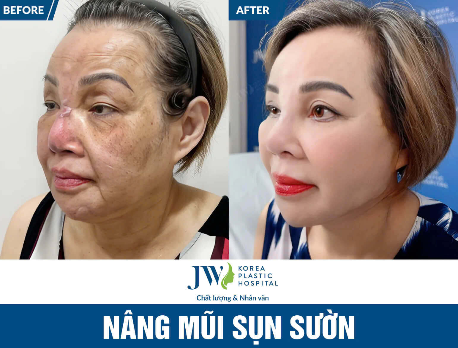nang-mui-sun-suon