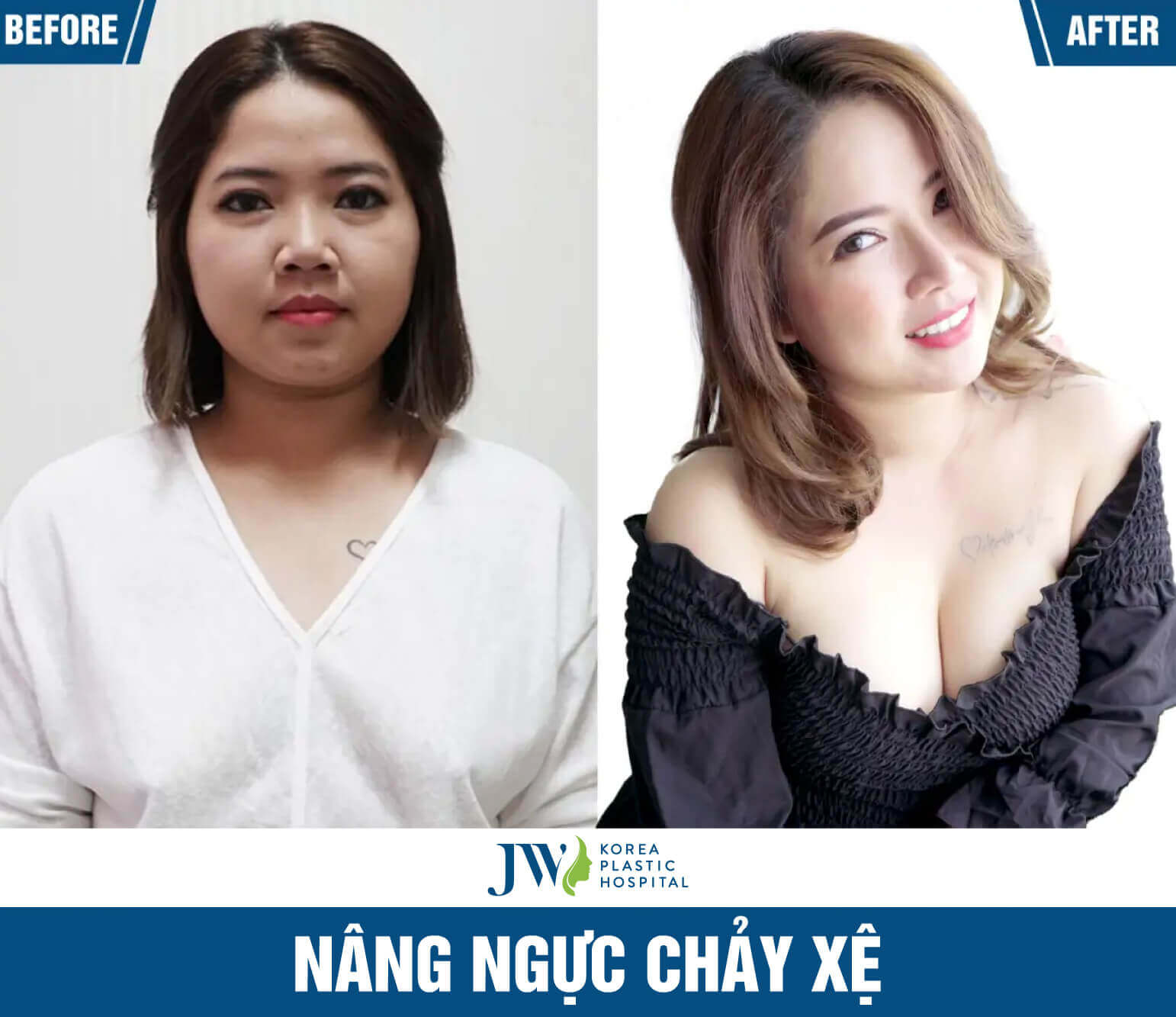 nang-nguc