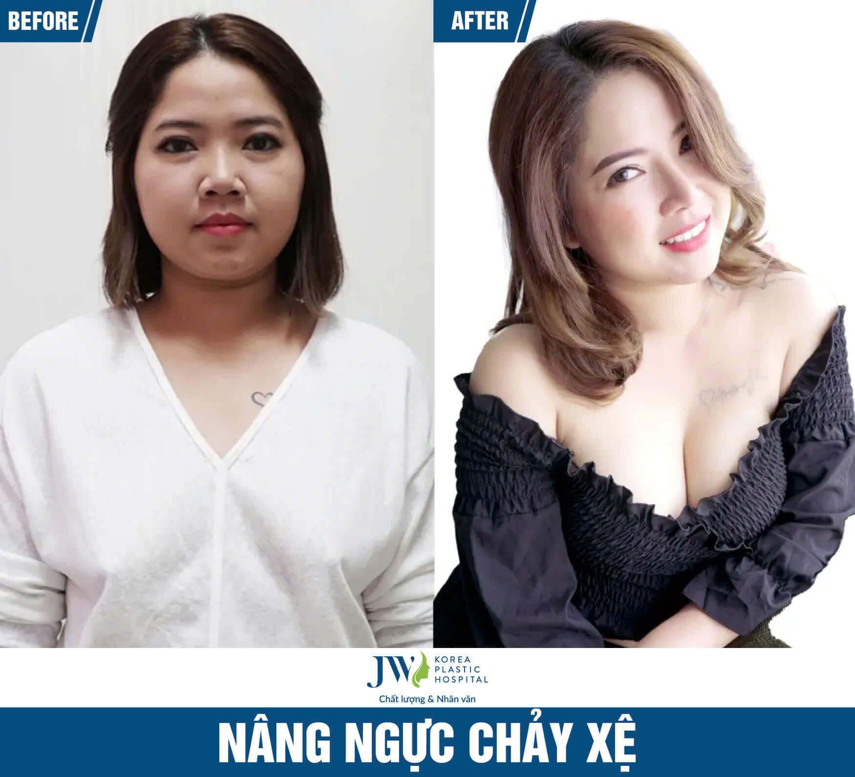 nang-nguc