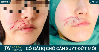 co gai bi cho can dut moi