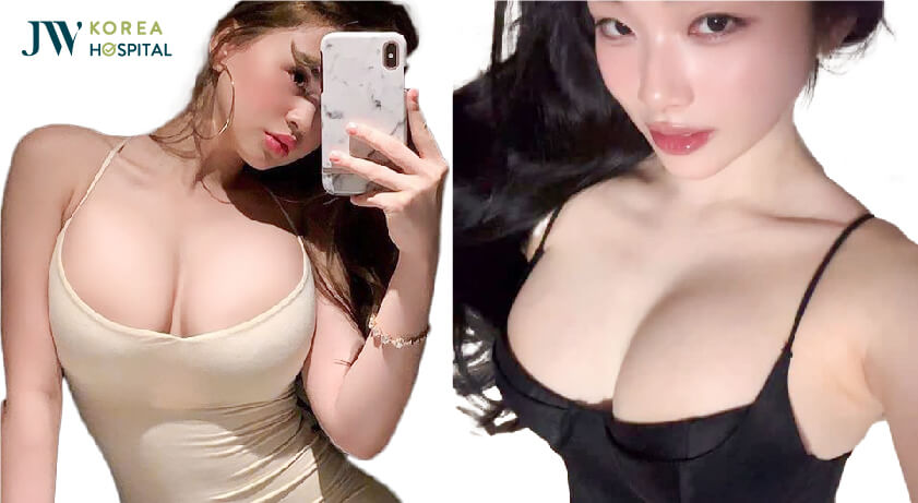 nâng ngực nội soi căng tròn, quyến rũ
