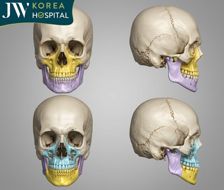 Công nghệ 3D giúp tính toán tỷ lệ khuôn mặt và điều chỉnh vị trí xương hàm chính xác