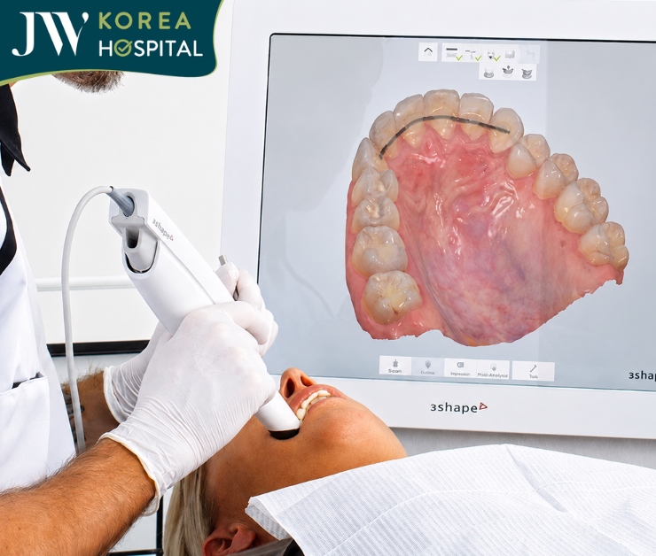 Quét mẫu hàm số hóa tái hiện chính xác răng và cung hàm